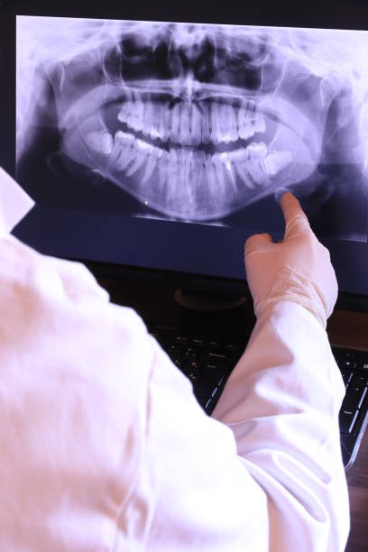Best Emergency Root Canal Treatment in Peppermill Village, MD